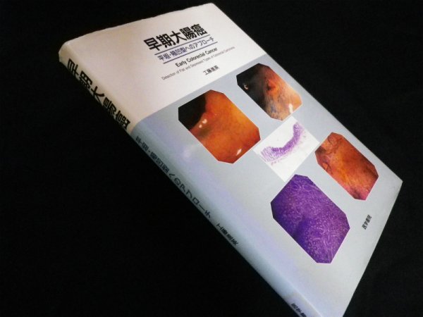 画像1: 早期大腸癌―平坦・陥凹型へのアプローチ　工藤進英 (1)