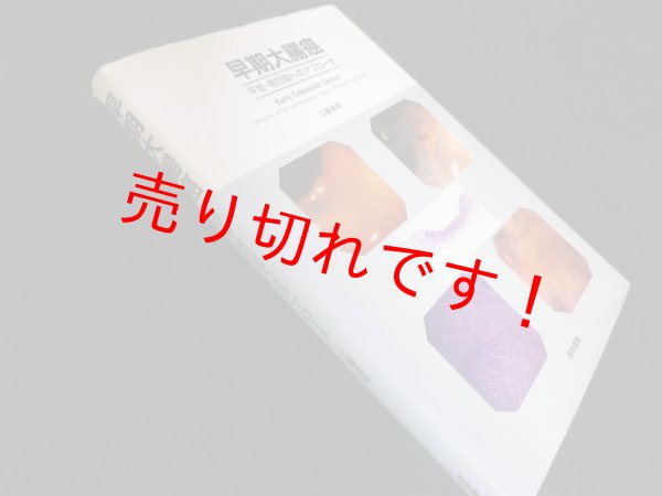 画像1: 早期大腸癌―平坦・陥凹型へのアプローチ　工藤進英 (1)