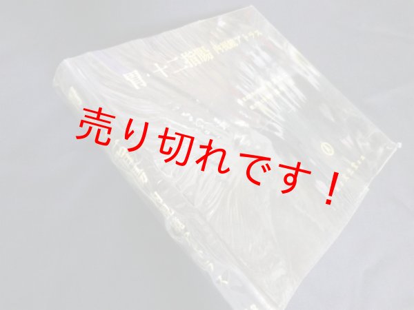画像1: 胃・十二指腸―内視鏡アトラス　芦沢真六 他 (1)